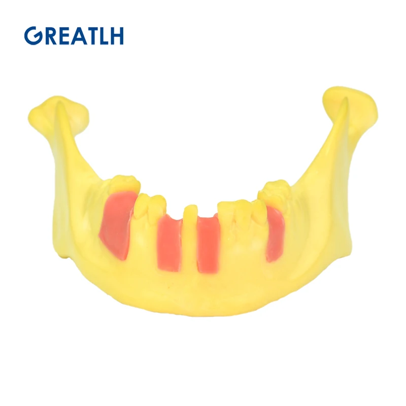 Istraživanje modela zuba, desni, vilice, edukativne model zuba, stomatološki materijal, stomatološki alat dvije vrste