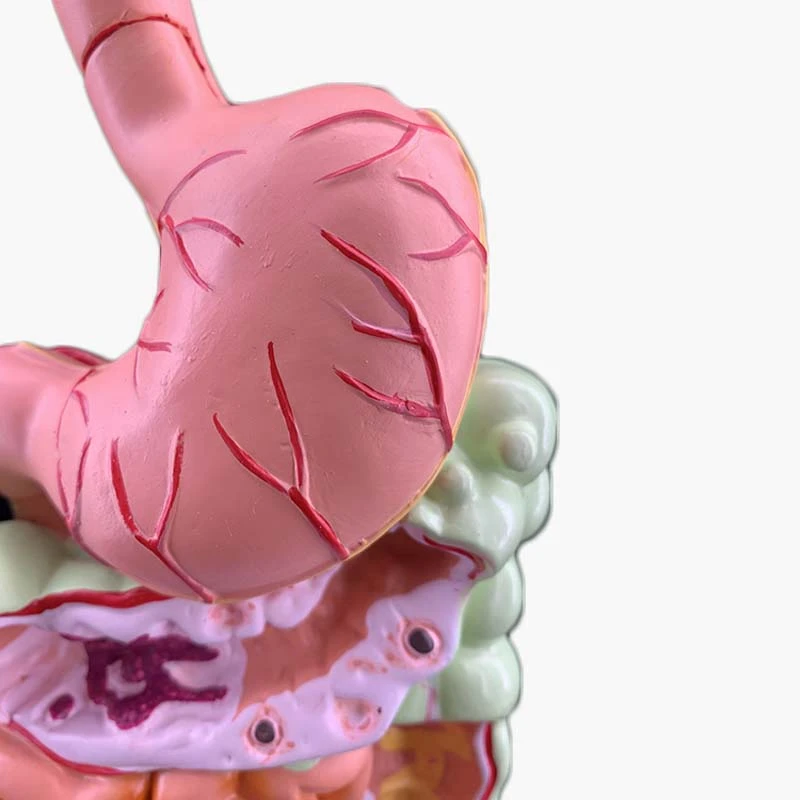 Model probavni sustav čovjeka Anatomija želuca Debeli crijevo Slijepo crijevo Izravna crijevo Двенадцатиперстная crijevo Model strukture unutarnjih organa čovjeka