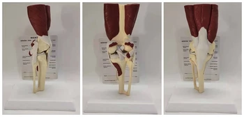 Model mišića koljena osobe, struktura ligamenata, мениск, kost, kostur, model objašnjenja medicinske nastave